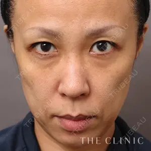 THE CLINIC（ザ・クリニック）東京院 大橋 昌敬医師の症例