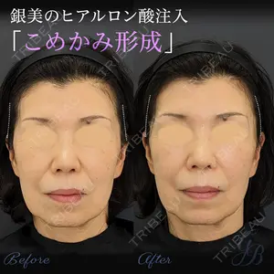 銀座美容外科クリニック 銀座院の症例