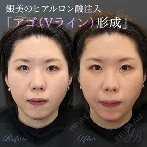 銀座美容外科クリニック 銀座院の症例
