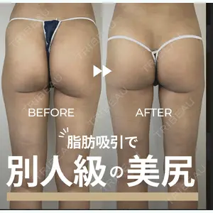 GAYA body design clinic 飯ヶ谷 重来医師の症例