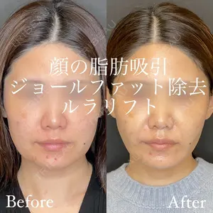 ルラ美容クリニック 名古屋院 酒井 俊行医師の症例