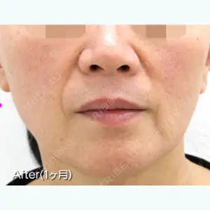 MIYAフェイスクリニック 宮里 裕医師の症例
