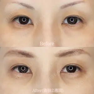 ハナビューティークリニック 厚田 幸子医師の症例