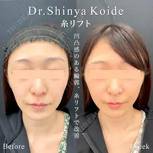 東京シンデレラ美容外科 池袋院 小出 真哉医師の症例