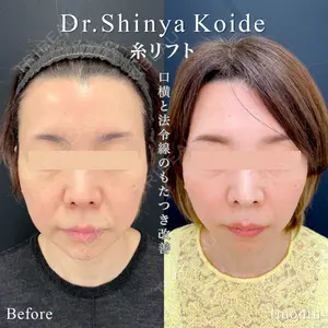 東京シンデレラ美容外科 池袋院 小出 真哉医師の症例