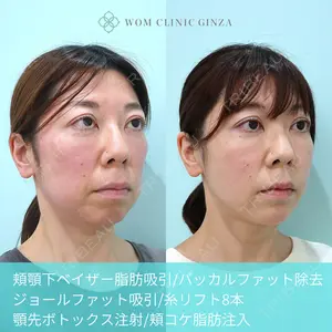 WOM CLINIC GINZA 深堀 純也医師の症例