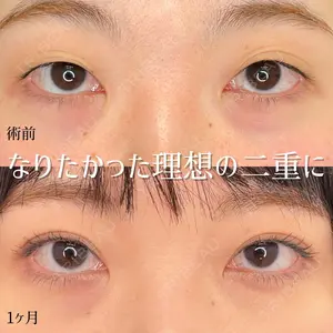 東京シンデレラ美容外科 池袋院 小出 真哉医師の症例