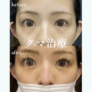 HAAB×DREAM BEAUTY CLINIC 東京本院 金子 雄医師の症例
