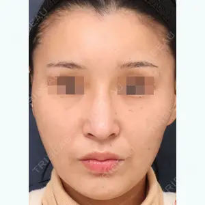 プリモ麻布十番クリニック 大場教弘医師の症例