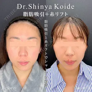 東京シンデレラ美容外科 池袋院 小出 真哉医師の症例