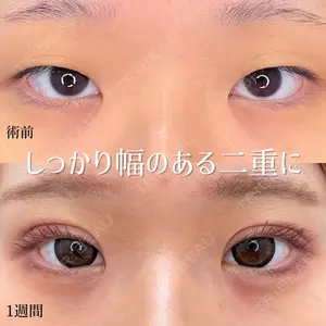 東京シンデレラ美容外科 池袋院 小出 真哉医師の症例