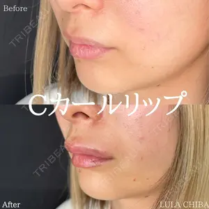 ルラ美容クリニック 千葉院 下川 洋輝医師の症例