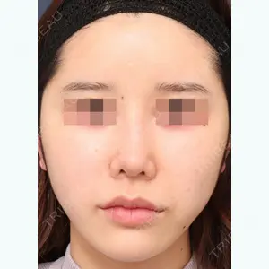 プリモ麻布十番クリニック 大場教弘医師の症例