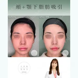 くさのたろうクリニック 立雅恵医師の症例