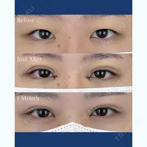 AI Beauty Clinic （エーアイ美容クリニック） 尾崎 宥文医師の症例