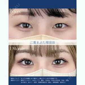 AI Beauty Clinic （エーアイ美容クリニック） 尾崎 宥文医師の症例