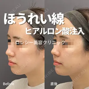 ロレシー美容クリニック 心斎橋駅前院 福留院長医師の症例