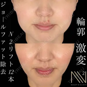 N2ビューティーアンドクリニック 銀座店の症例