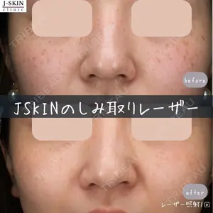 Jスキンクリニック 【J-SKIN clinic】 牧野　潤医師の症例