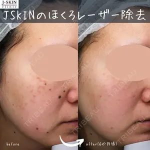 Jスキンクリニック 【J-SKIN clinic】 牧野　潤医師の症例