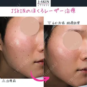 Jスキンクリニック 【J-SKIN clinic】 牧野　潤医師の症例
