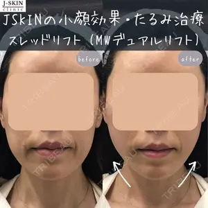 Jスキンクリニック 【J-SKIN clinic】 牧野　潤医師の症例