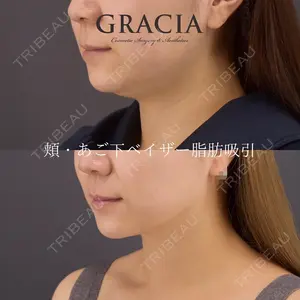 Casa de GRACIA GINZA 樋口　隆男理事長医師の症例