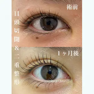 HAAB×DREAM BEAUTY CLINIC 東京本院 田中 優太医師の症例