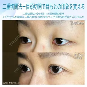 聖心美容クリニック 札幌院 前多 一彦医師の症例