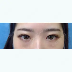 新宿美容外科クリニック 新宿院 井上　淳　医師の症例