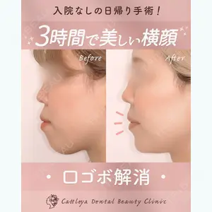 カトレア歯科・美容クリニック 辻 和志医師の症例