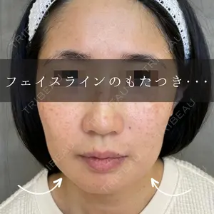ルラ美容クリニック 渋谷本院 昼間 路子医師の症例