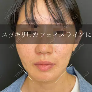 ルラ美容クリニック 渋谷本院 昼間 路子医師の症例