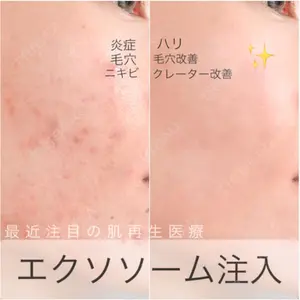 CHARIS BEAUTY CLINIC 西平　守明医師の症例