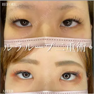 ルラ美容クリニック 高田馬場院 若佐 卓矢医師の症例