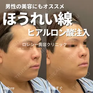 ロレシー美容クリニック 心斎橋駅前院 福留院長医師の症例