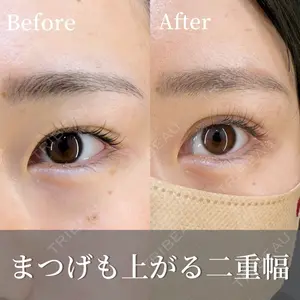 HAAB×DREAM BEAUTY CLINIC 東京本院 金子 雄医師の症例