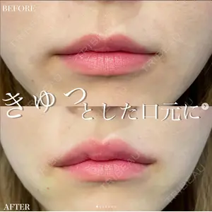 ルラ美容クリニック 高田馬場院 若佐 卓矢医師の症例