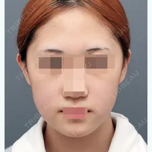 ITEM美容（整形）外科 シン・キョンジン医師の症例