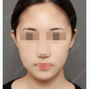 ITEM美容（整形）外科 シン・キョンジン医師の症例