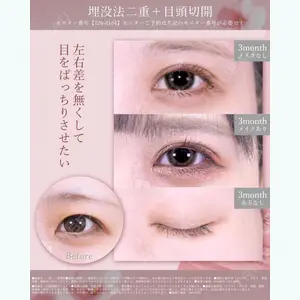 湘南美容クリニック 六本木院 本間 重行医師の症例