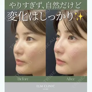 美容皮膚科エルムクリニック 麻布院 横山 歩依里医師の症例