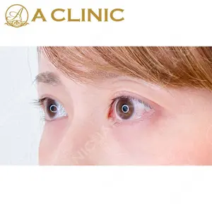 A CLINIC（エークリニック） 名古屋院 住田 篤紀医師の症例