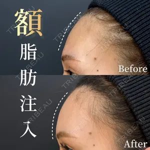 HAAB×DREAM BEAUTY CLINIC 東京本院 金子 雄医師の症例