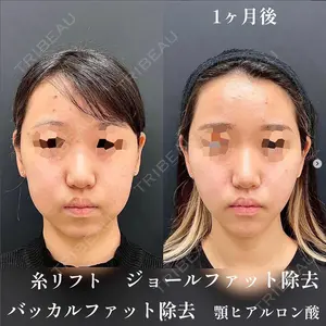 大阪TAクリニック 平松 敦医師の症例