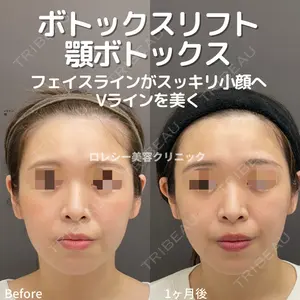 ロレシー美容クリニック 心斎橋駅前院 福留院長医師の症例