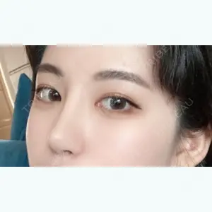 NANA（ナナ）美容外科 キム・ヒョンジュン医師の症例