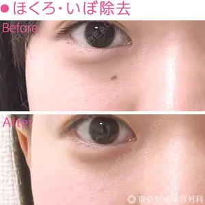 東京形成美容外科 船橋院 弓削田　浩主医師の症例