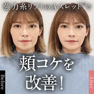 A CLINIC（エークリニック） 仙台院 中村 光宏医師の症例