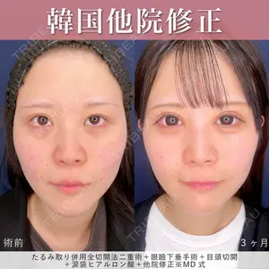 東京シンデレラ美容外科 新宿院 吉原 伯医師の症例